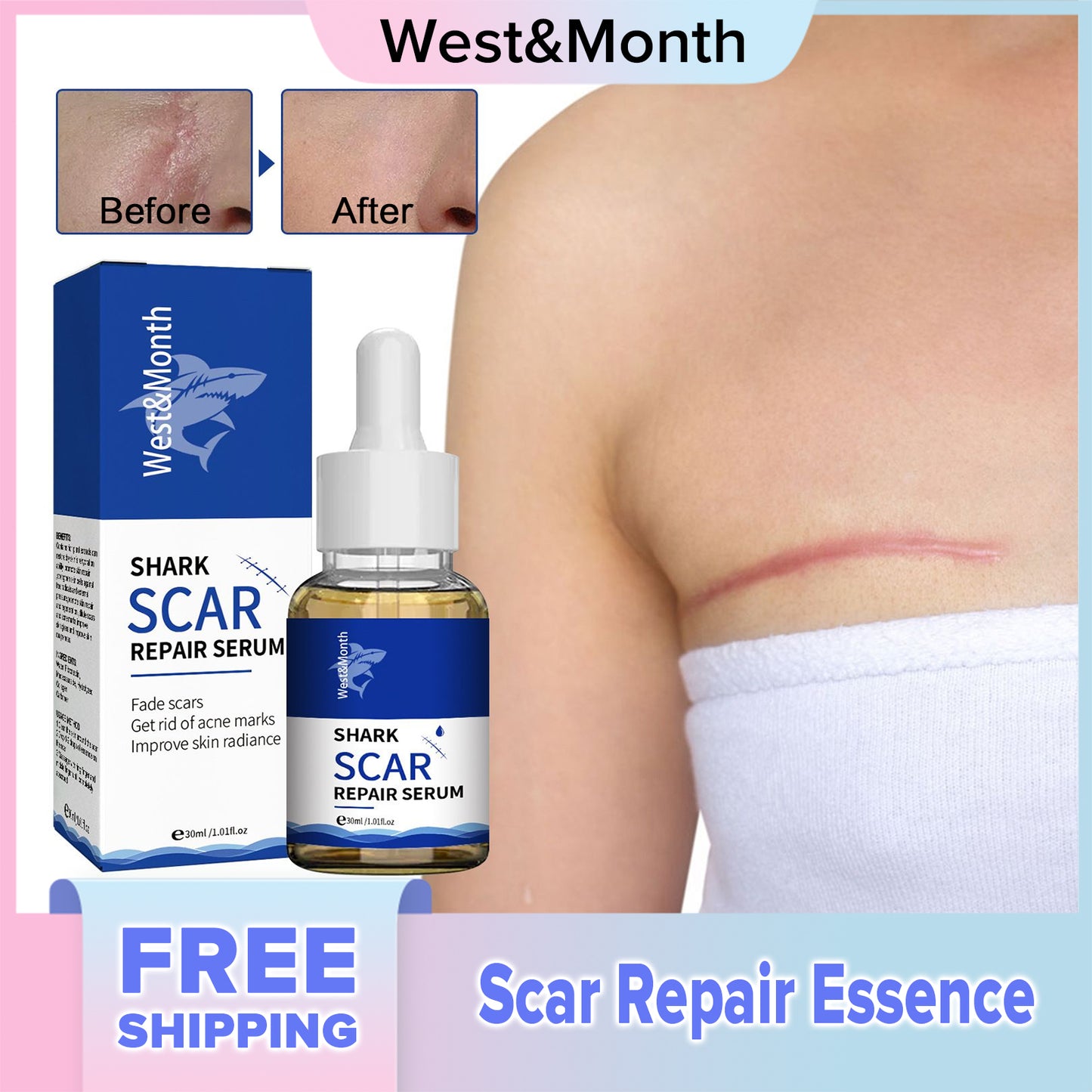 West&Month Scar Repair Essence Fade Concave And Convex Scars Repair Pockmarks Pit Pockmarks Tender And Smooth Skin Essence(30ml)