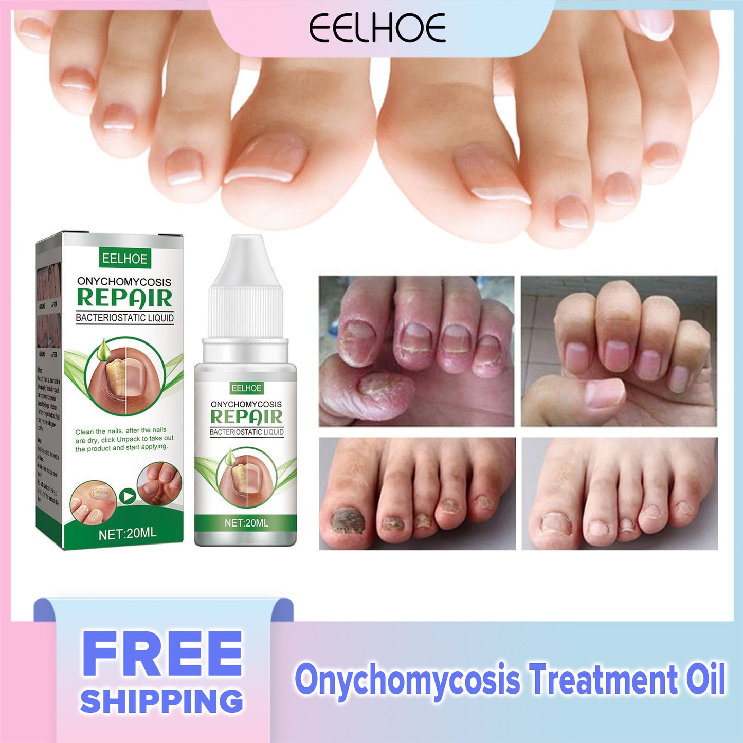 EELHOE Onychomycosis Treatment Oil Toenail Fungus Nail Fungal Infection Removal Paronychia Repair Essence Foot Nail Care Liquid(20ml)