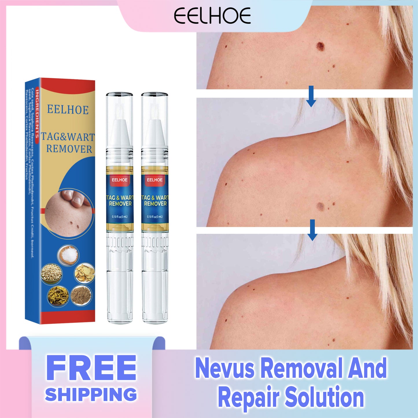 EELHOE Warts Remover Pen For Remove Wart Cells Quickly and Painlessly Body Care