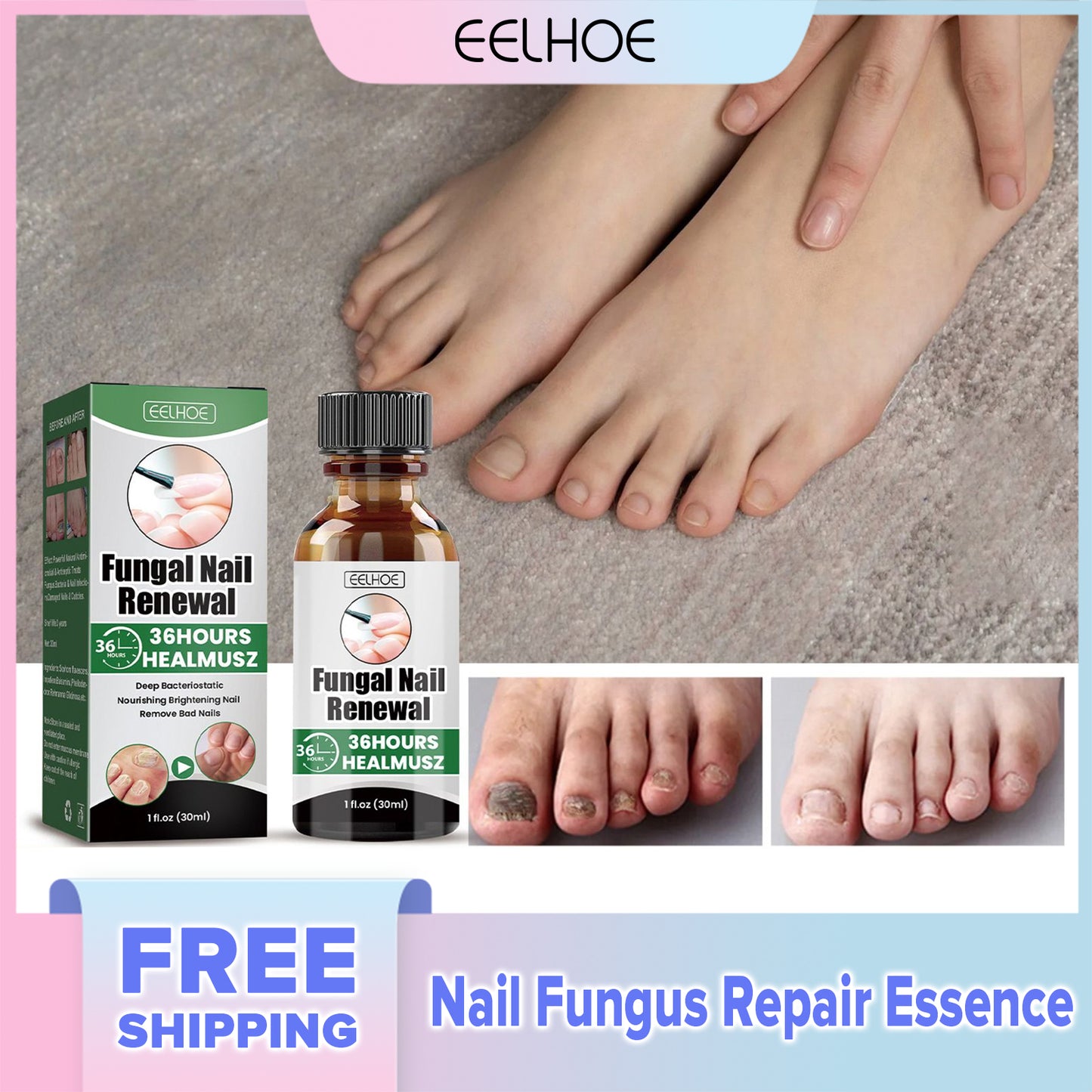 EELHOE Nail Fungus Repair Essence Fungal Toenail Renewal Anti-Infective Paronychia Onychomycosis Treatment Hand Foot Nail Care(30ml)
