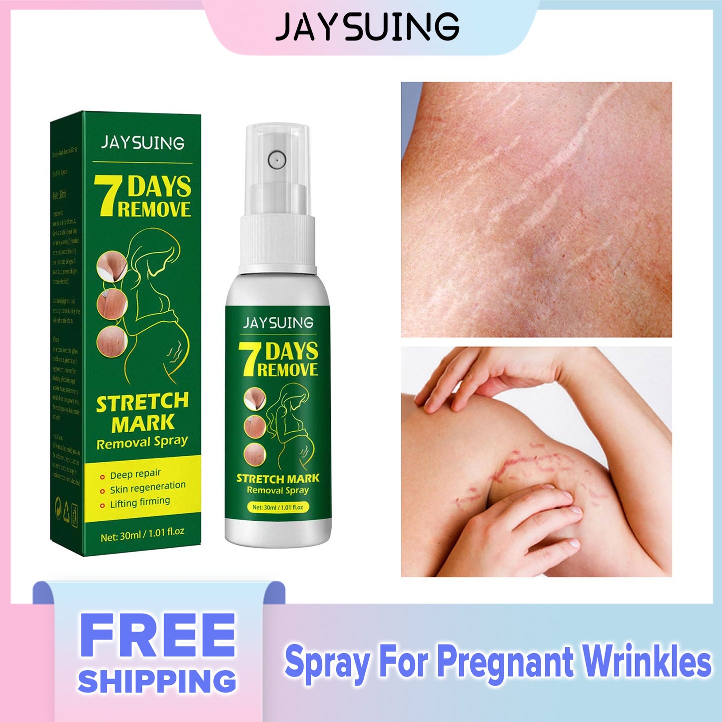 Jaysuing Spray For Pregnant Wrinkles Repair Postpartum Care Fade Pregnant Wrinkles Pregnant Wrinkles Body Skin Care Fluid (30ml)
