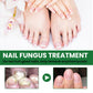 EELHOE Nail Fungus Repair Essence Fungal Toenail Renewal Anti-Infective Paronychia Onychomycosis Treatment Hand Foot Nail Care(30ml)