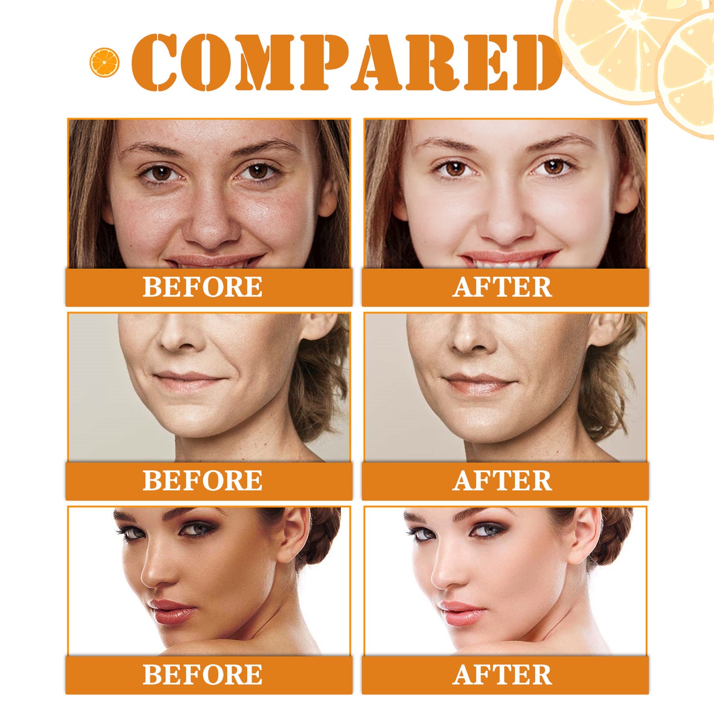 EELHOE Vitamin C Facial Essence Hydrating, Moisturizing, Brightening Skin Tone, Dimming And Repairing Essence(30ml)