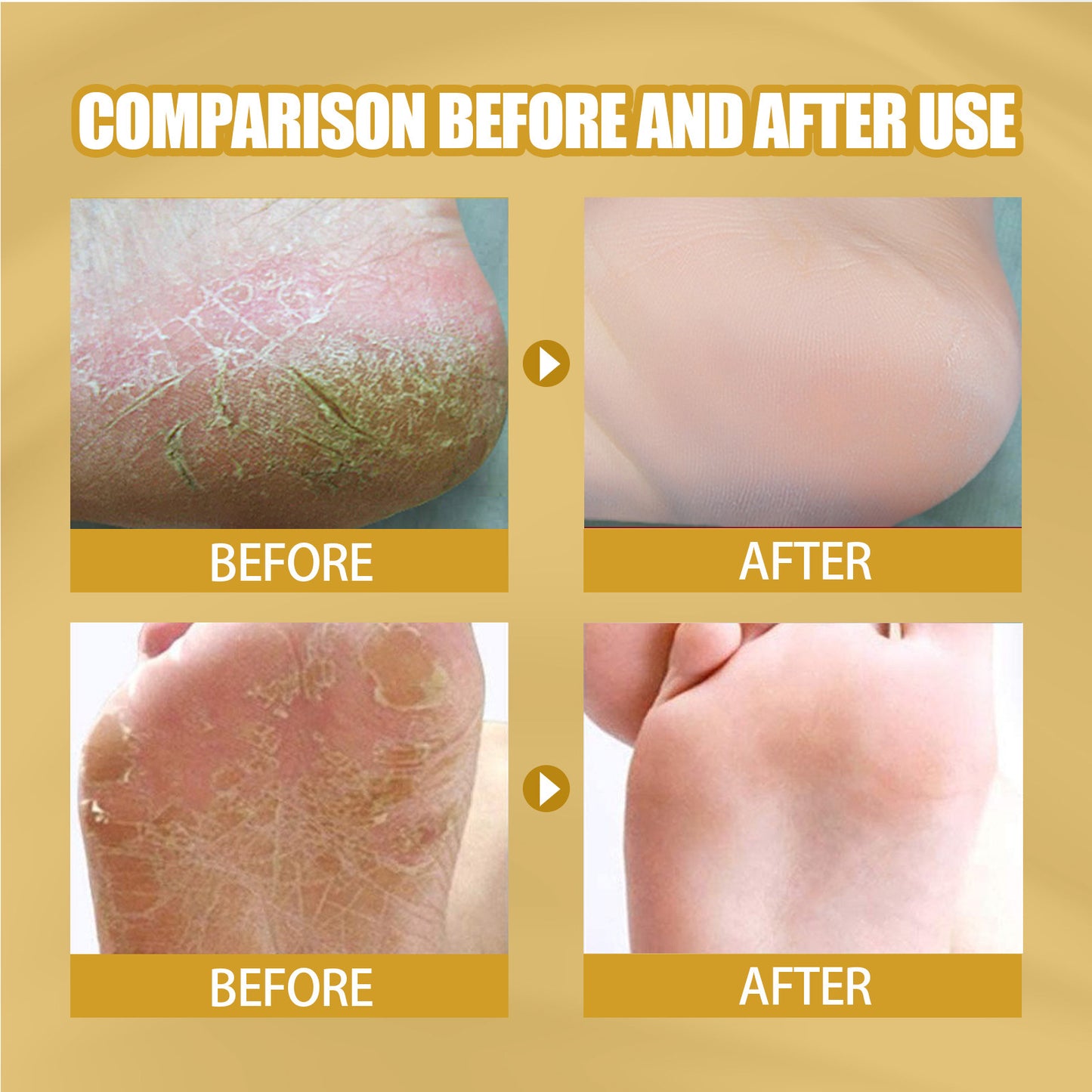 EELHOE Skin Cracking Banana Repair Cream Foot Care Anti freezing Crack Anti Dry Cracking Hand and Foot Care Repair Cream(20g)