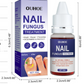 OUHOE Nail Repair Solution For Repairing Thickened Nails, Inlaid Nails, Gray Nails, Bright Nails, Soft Nails(10ml)
