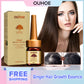 OUHOE Ginger Hair Growth Essence Repairs Hair Follicle Damage Dry, Hairy, Moisturizing, Nourishing And Tough Essence(60ml)