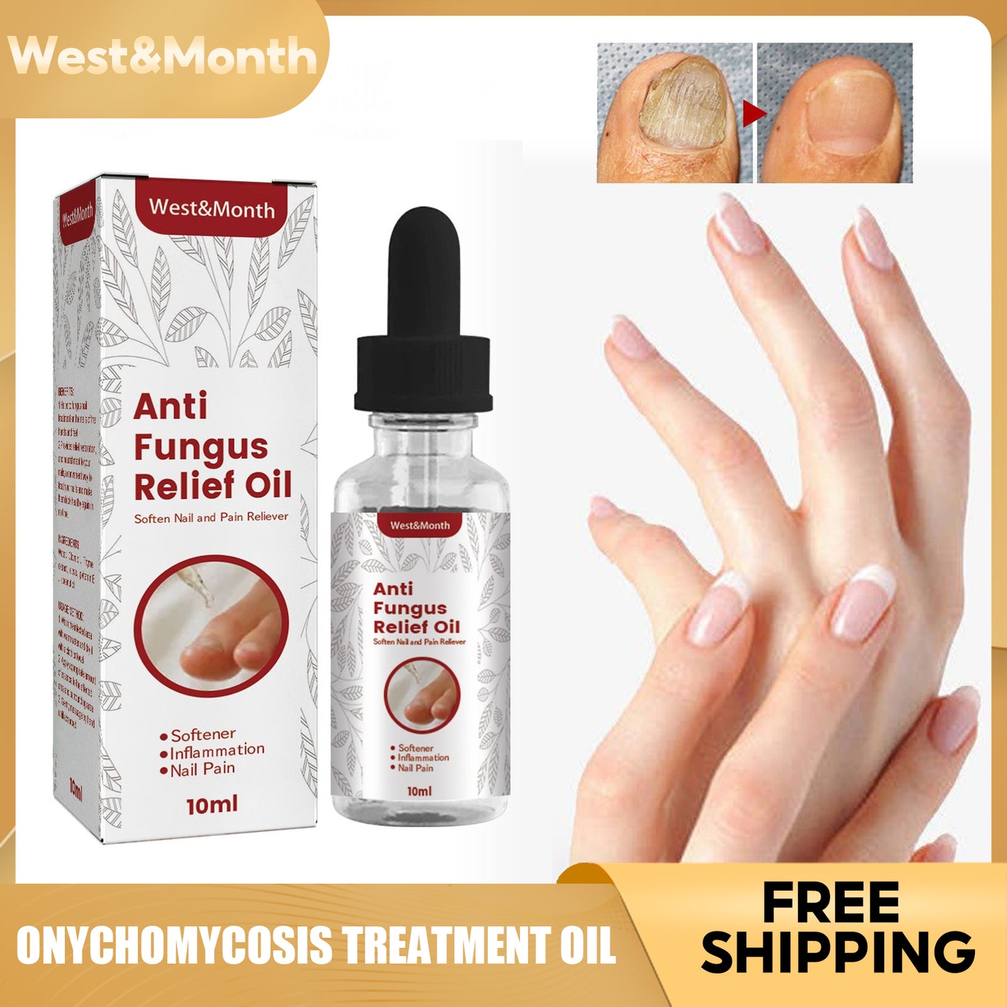 West&Month Onychomycosis Treatment Oil Toenail Fungus Nail Fungal Infection Removal Paronychia Repair Essence Foot Nail Care Liquid(10ml)