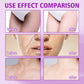 OUHOE Anti Wrinkle Whitening Cream Freckles Removal Melasma Brighten Lighten Melanin Firming Lifting Face Care Cream for Women(50g)