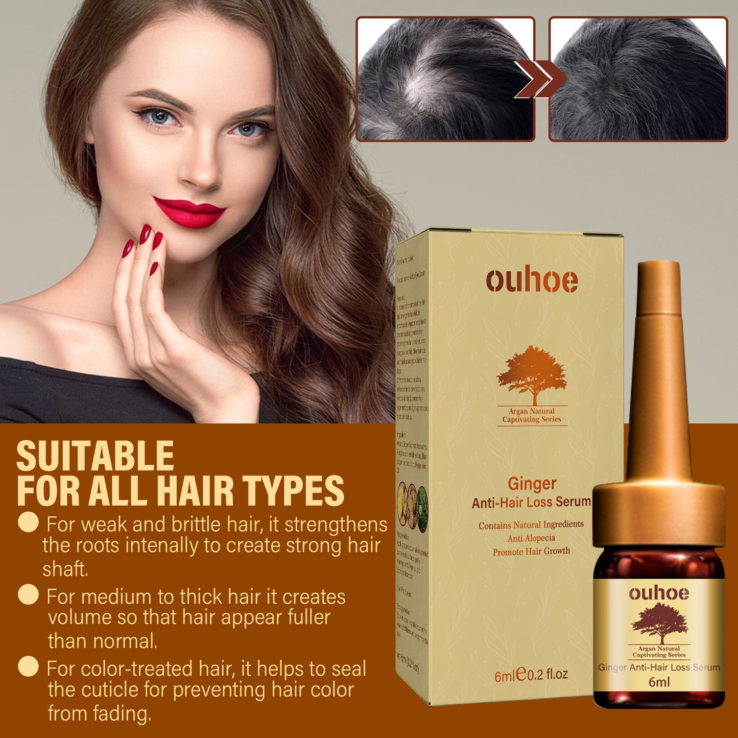 OUHOE Ginger Hair Growth Essence Repairs Hair Follicle Damage Dry, Hairy, Moisturizing, Nourishing And Tough Essence(60ml)