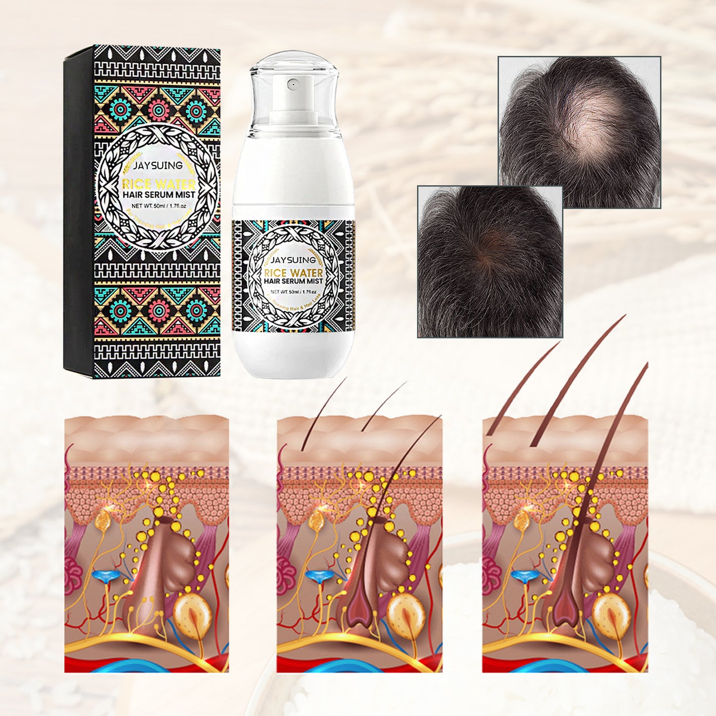 Jaysuing Hair Growth Spray Moisturizing Nourishing Thicken Hair Care Essential Oil Anti Hair Loss Spray Scalp Treatment For Men Women