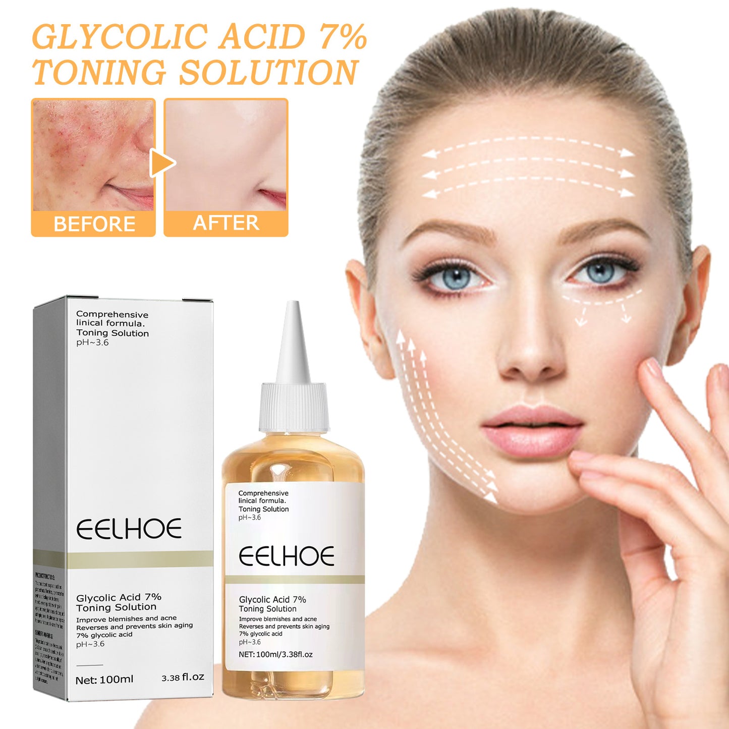 EELHOE Glycolic Acid 7% Toner to Remove Acne, Fade Acne Marks, Remove Closed Mouth Acne, Repair Skin, Moisturize and Tender Skin(100ml)