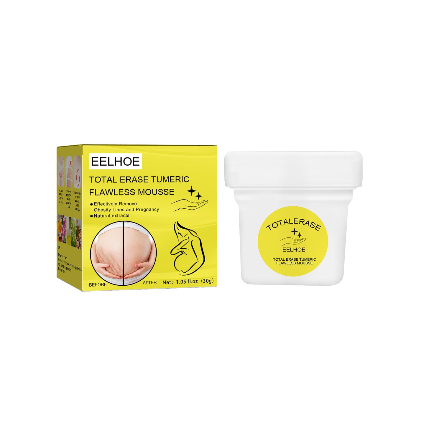 EELHOE 30g Stretch Mark Cream Removes Stretch Mark Body Care