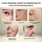 EELHOE Collagen Anti Aging Serum Remove Wrinkles Eye Lines Pores Refining Dark Spots Corrector Whitening Firming Facial Essential Oil(30ml)