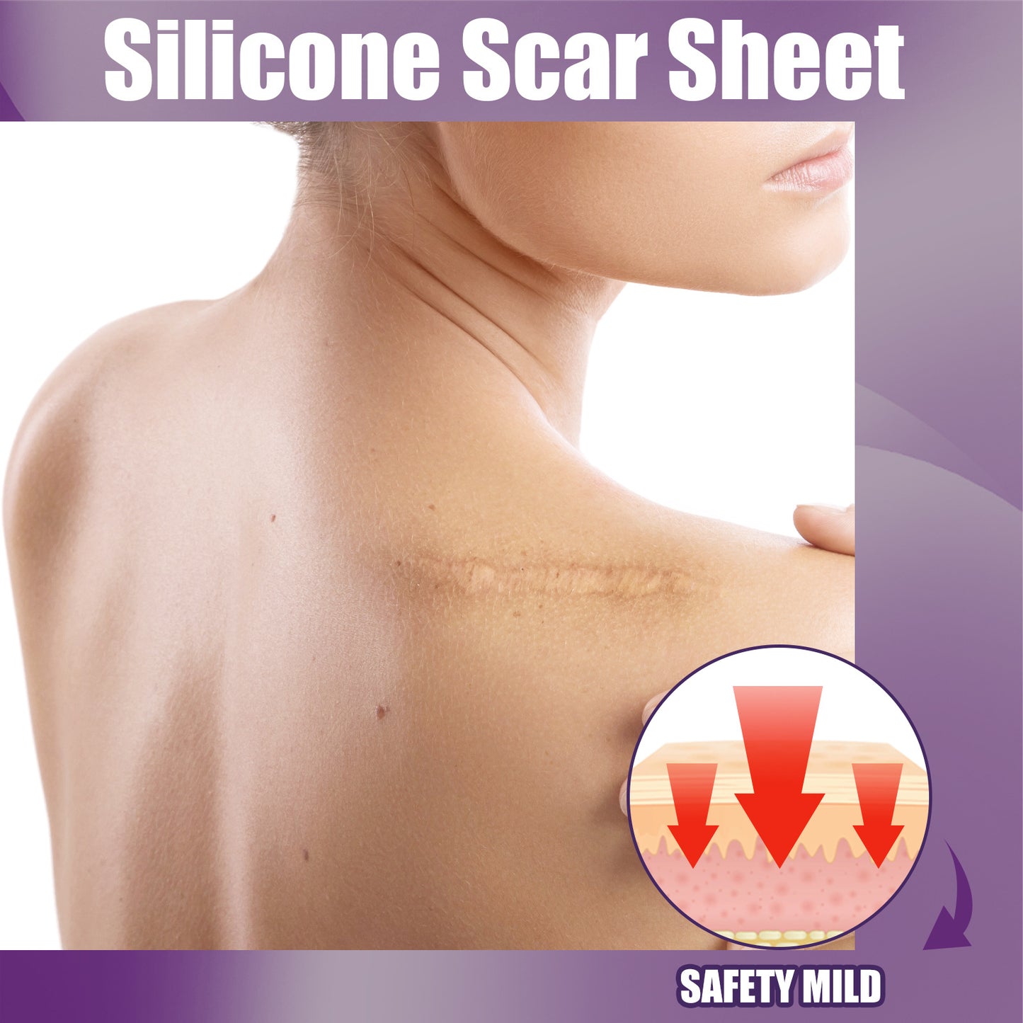EELHOE Silicone Scar Sticker Fade Scars Stretch Marks
