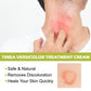 South Moon Skin White Spot Cream Care Health Effective Dermatitis Vitiligo Skin Topical Medical Repair Melanin Disease Cream