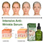 EELHOE Anti-Aging Serum Face Serum for Dewy Looking Skin Hydrate Moisturize Plump Skin Reduce Wrinkles(20ml)