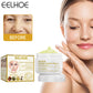 EELHOE Cream Brightening Skin Moisturizing Moisturizing Diminish Spots Anti-aging (1 Can)