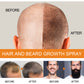 Jaysuing Hair Growth Spray Men's Hair Beard Dense Growth Care Solution Tough Hair Quality Prevents Loss(100ml)