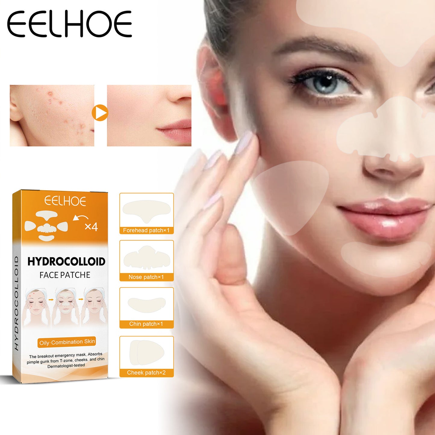 EELHOE Hydrogel Facial Acne Patch Close-up Acne Fade Acne Mark Repair Cleansing (20pcs)