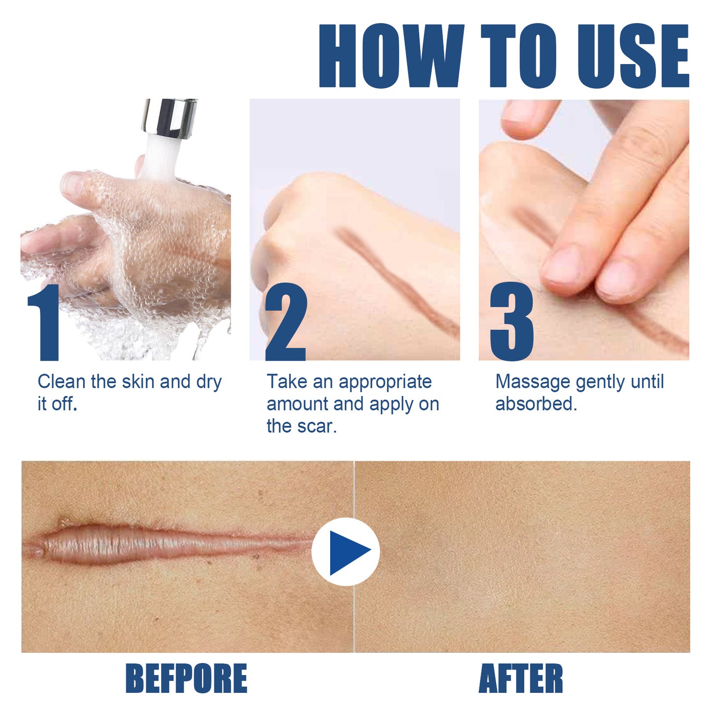 EELHOE Scar Removal Cream For Face and Body, Old and New Cuts Scars