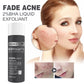 OUHOE Salicylic Acid Essence Original Solution Repairing Skin Acne, Acne, Fine Pore, Skin Care And Rejuvenation Essence (30ml)