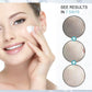 EELHOE Dark Spot Cream Relieves Facial Skin Melanin Improves Dark Spots